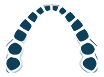 Aligners